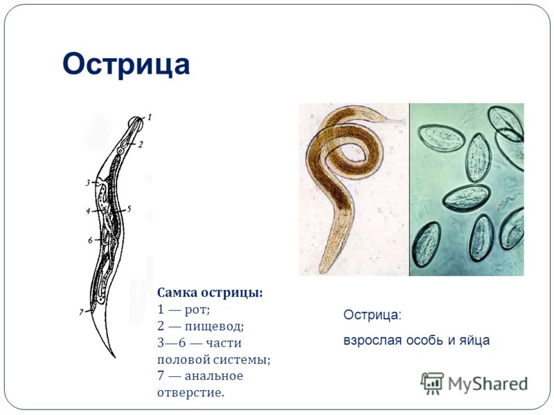 капли для выведения паразитов из организма человека капли для выведения паразитов из организма человека