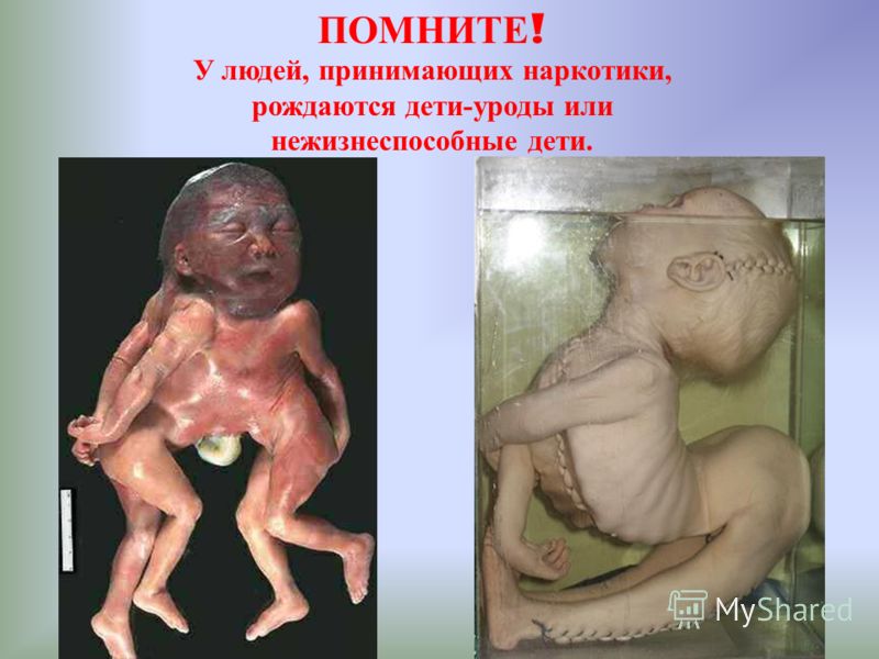 Самые странные новорожденные 60 Самые странные новорожденные 99