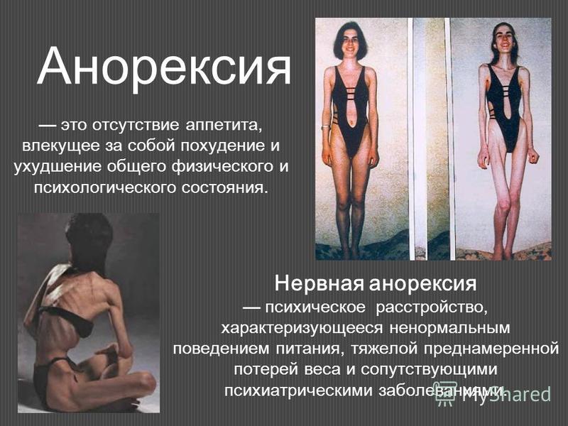 an introduction to the anorexia nervosa and the issue of the abnormal weight loss Eating disorders online medical reference - covering definition through treatment authored by kathleen n franco of the cleveland clinic eating disorders are syndromes characterized by severe disturbances in eating behavior and by distress or excessive concern about body shape or weight. an introduction to the anorexia nervosa and the issue of the abnormal weight loss Eating disorders online medical reference - covering definition through treatment authored by kathleen n franco of the cleveland clinic eating disorders are syndromes characterized by severe disturbances in eating behavior and by distress or excessive concern about body shape or weight.