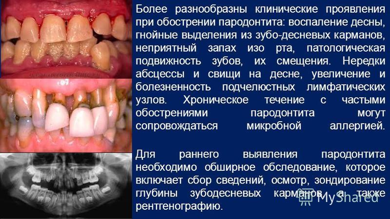 Как вязать рукав. Описание, схема и выкройка - Вязание Как выбрать пряжу