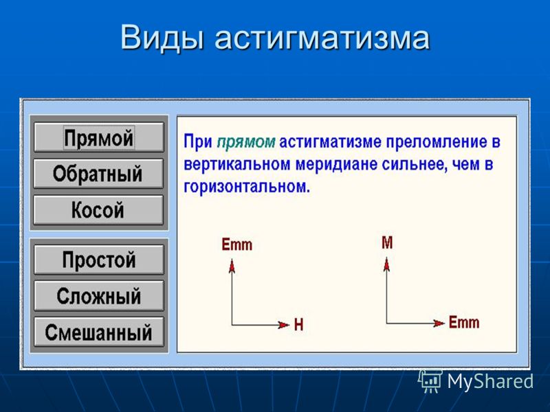 Астигматизм в год