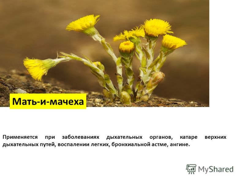 Боли внизу живота при беременности 3 недель