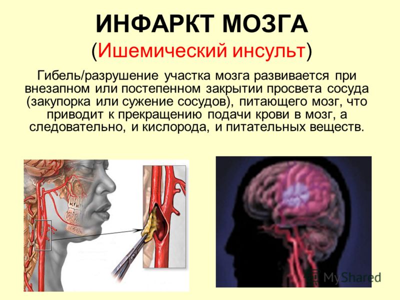 нарушение сна при панкреатите нарушение сна при панкреатите