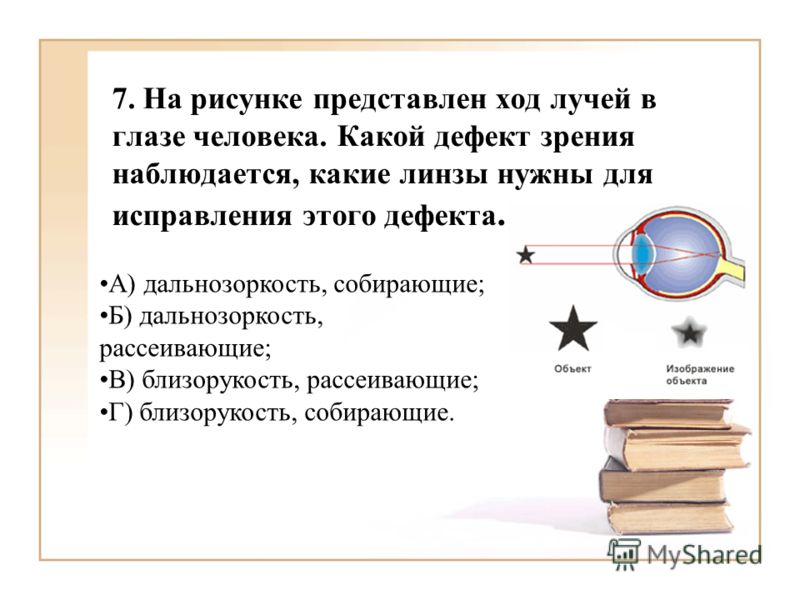 Если близорукость это минус или плюс
