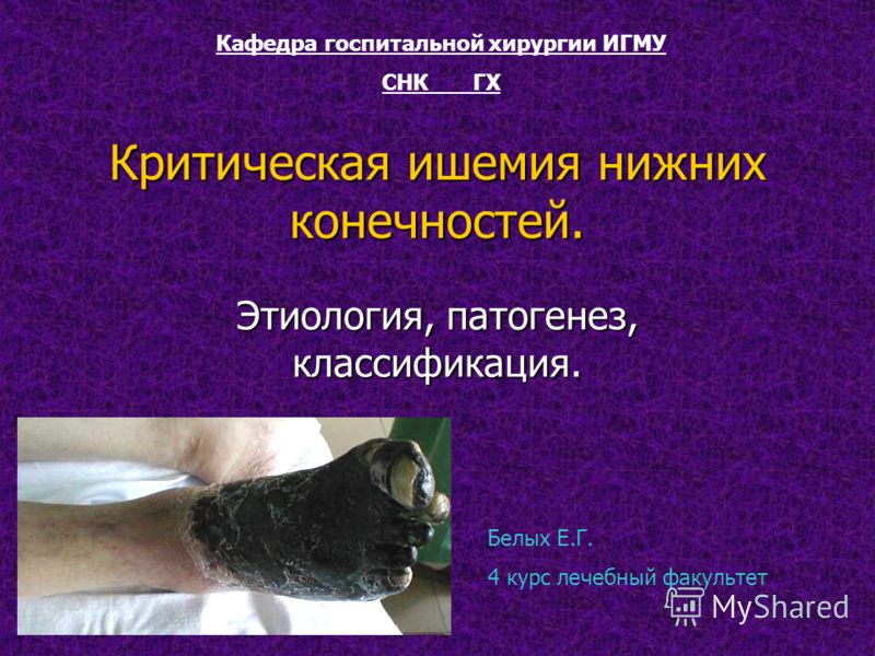 облитерирующий атеросклероз этиология патогенез