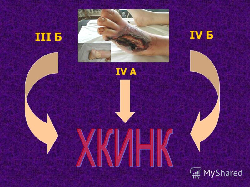 III Б IV A IV Б