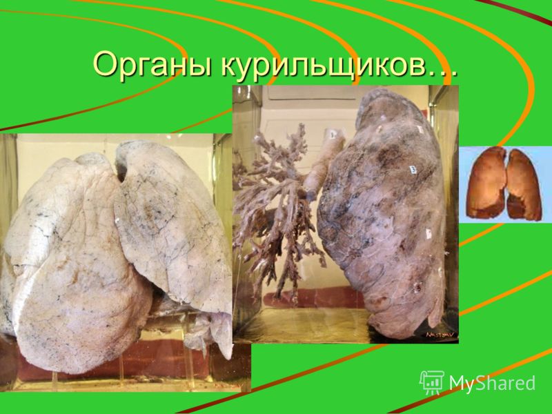 Органы курильщиков…
