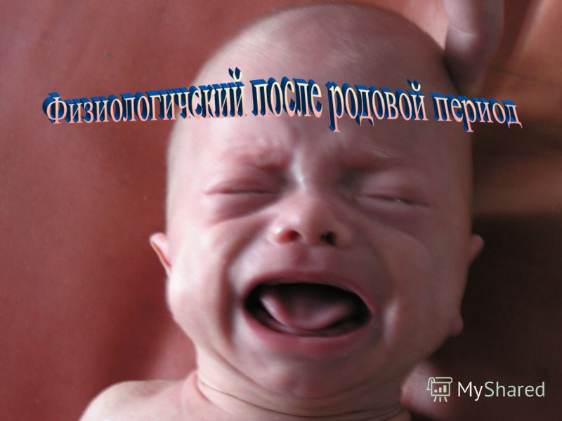 растяжение брюшной стенки
