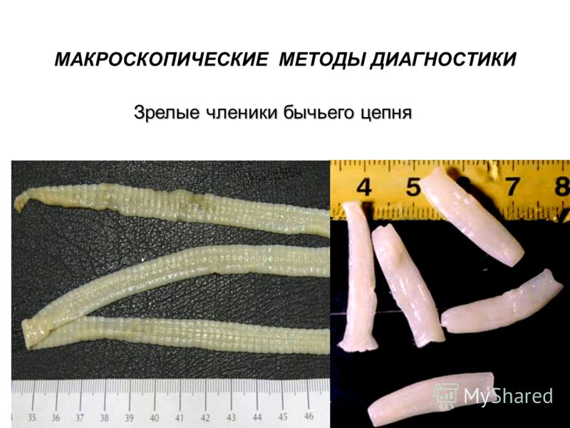микроскопические насекомые паразиты на теле человека микроскопические насекомые паразиты на теле человека