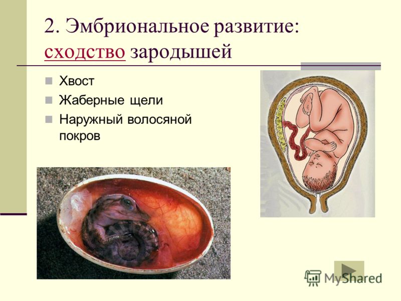 как вылечить паразитов в организме человека как вылечить паразитов в организме человека