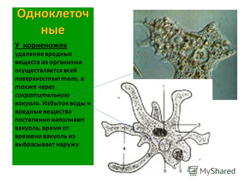 очищение от паразитов с помощью лука отзывы очищение от паразитов с помощью лука отзывы