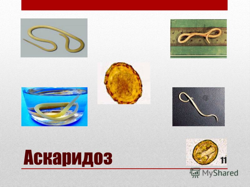 кашель от паразитов кашель от паразитов
