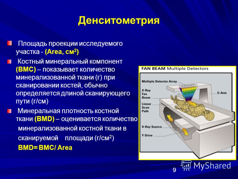 9 Денситометрия Площадь проекции исследуемого участка - (Area, см 2 ) Костный минеральный компонент (ВМС) – показывает количество минерализованной ткани (г) при сканировании костей, обычно определяется длиной сканирующего пути (г/см) Минеральная плот