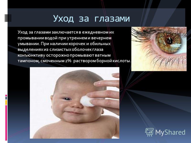 Уход за глазами человек Уход за глазами человек
