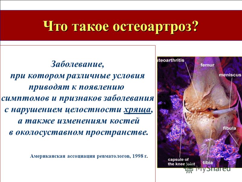 Презентация школа болезни суставов и позвоночника компрессы из листьев лопуха при воспалении сустава