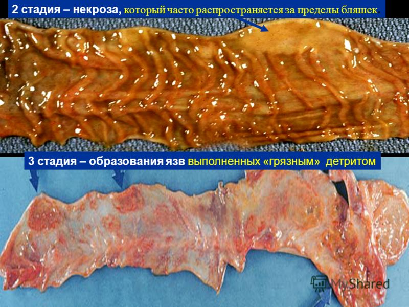 стадия пролиферации