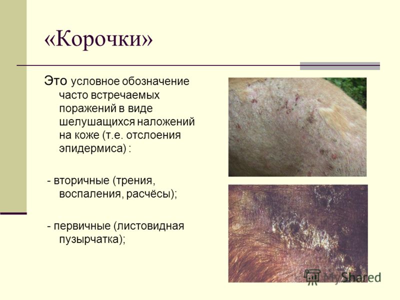 Как выглядит пузырчатка на коже Листовидная пузырчатка у собак картинки Crocomics.ru