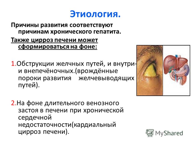 Плавленный сыр при заболеваниях печени