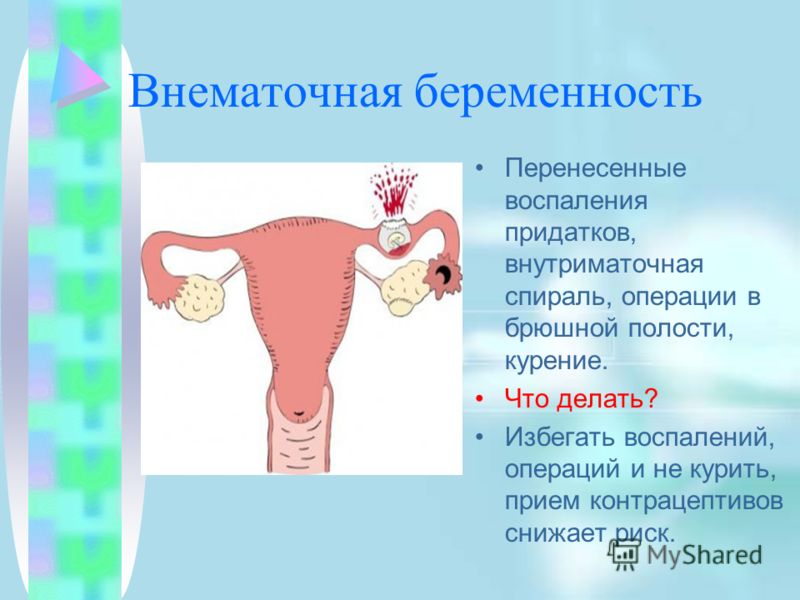 Малыш, а пойдём погуляем по крышам? / Владимир Кезлинг Консультация детского психолога: Кризис 3 лет