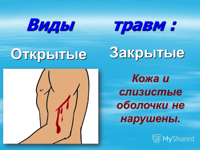 Окружающий мир 4 класс виноградова тема травмы