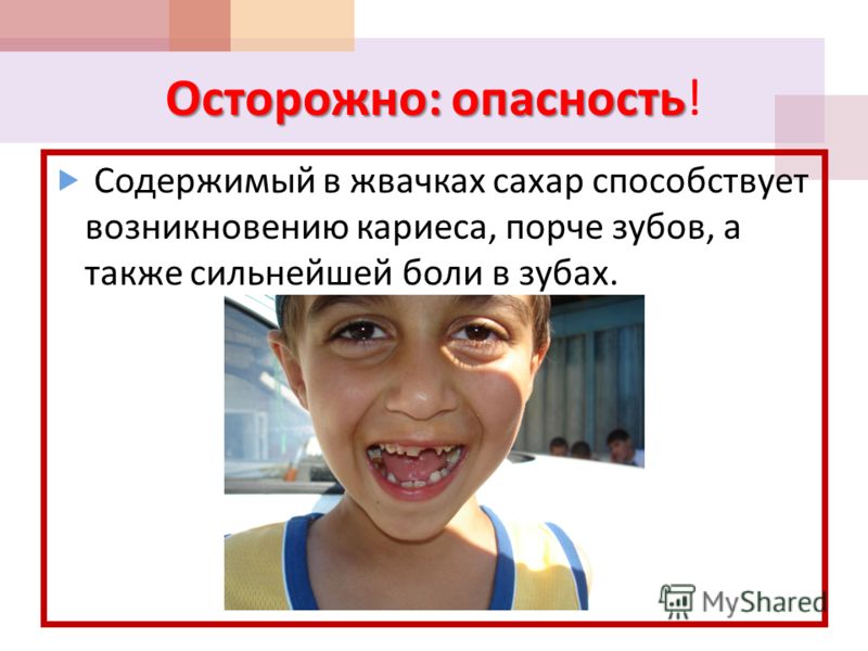 Презентации по заболеваниям зубов Презентации по заболеваниям зубов
