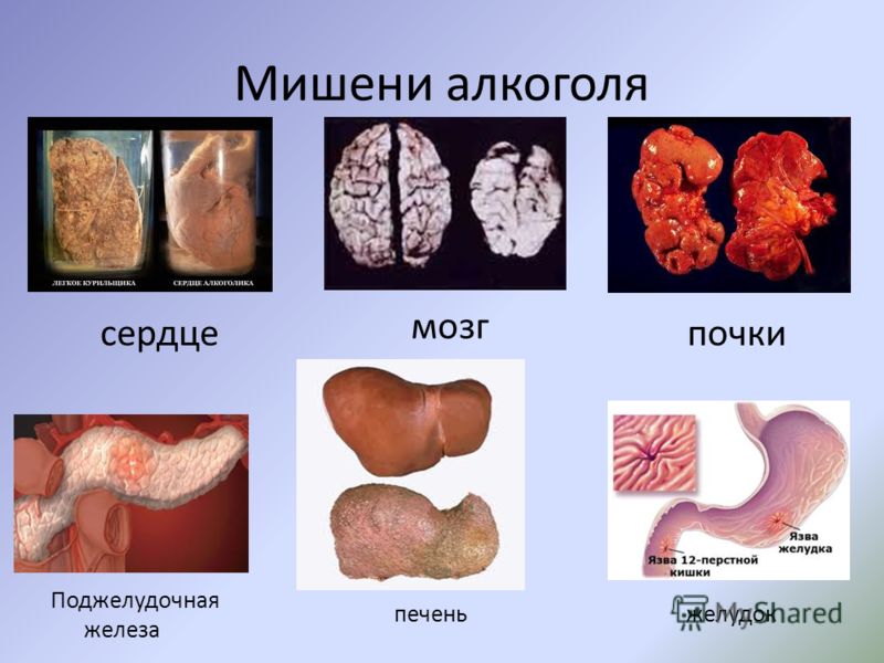 Хочу 2 ребенка но муж пьет