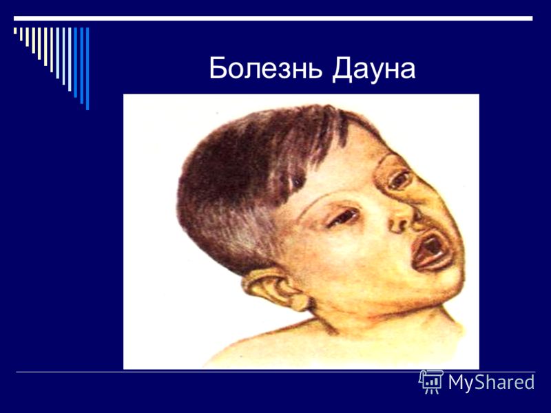 Родинки на голове появились и болят