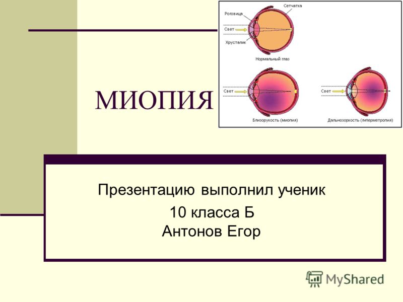 Реферат: Профилактика близорукости у детей и подростков