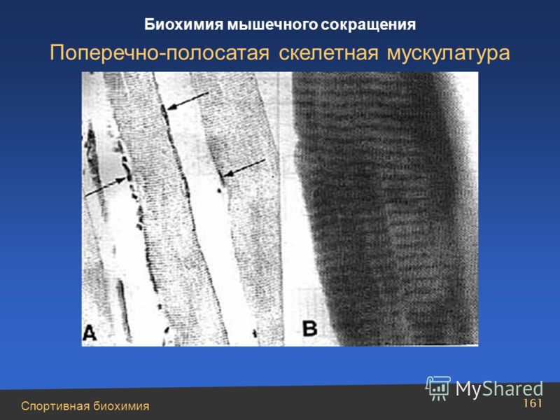 Спортивная биохимия 161 Биохимия мышечного сокращения Поперечно-полосатая скелетная мускулатура