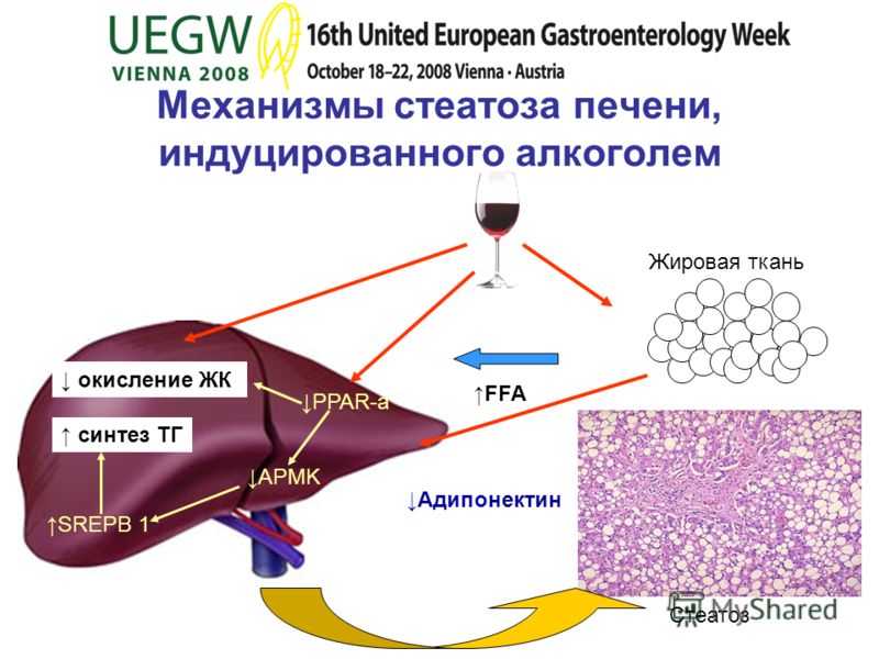Механизмы стеатоза печени, индуцированного алкоголем Стеатоз Жировая ткань окисление ЖК синтез ТГ FFA Адипонектин SREPB 1 APMK PPAR-a