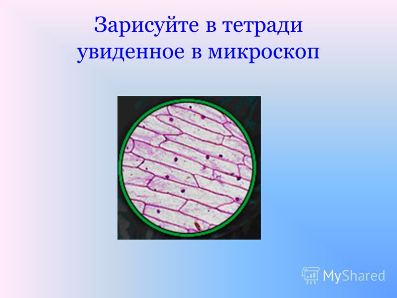 Фото Кожицы Лука Под Микроскопом Фото Кожицы Лука Под Микроскопом