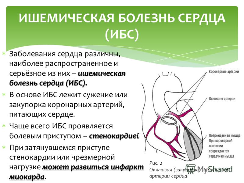 Реферат: Болезни сердца