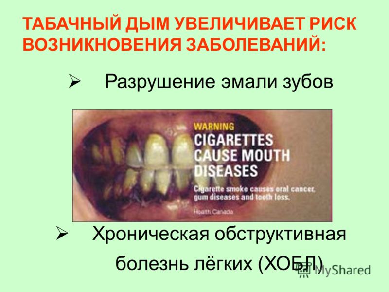 Почему у ребёнка заячья губа Почему у ребёнка заячья губа