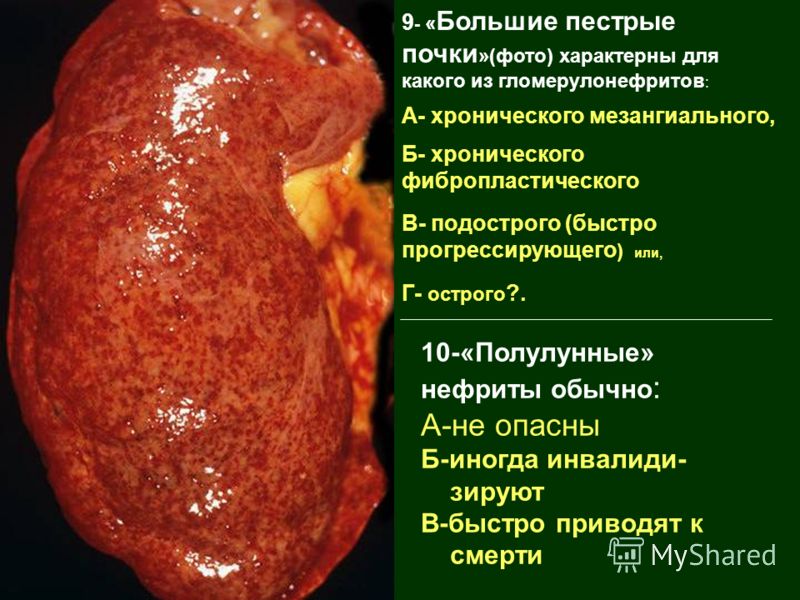 чем опасен пиелонефрит почек квартиру
