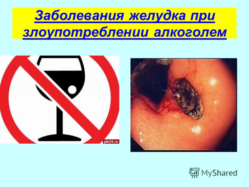 табачный запах изо рта табачный запах изо рта
