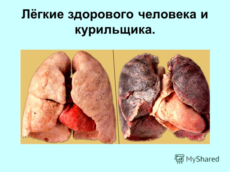 запах сигарет изо рта у некурящего запах сигарет изо рта у некурящего