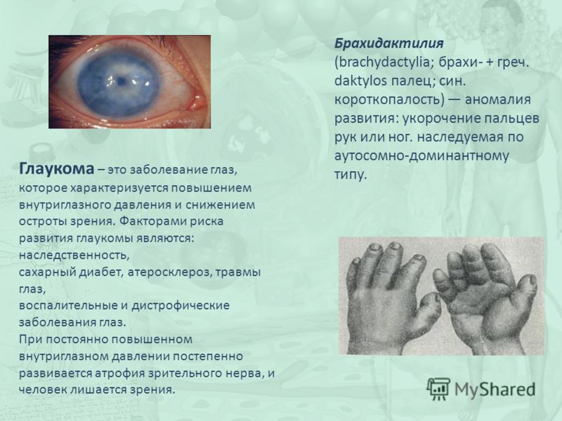 укорочение пальцев ног укорочение пальцев ног