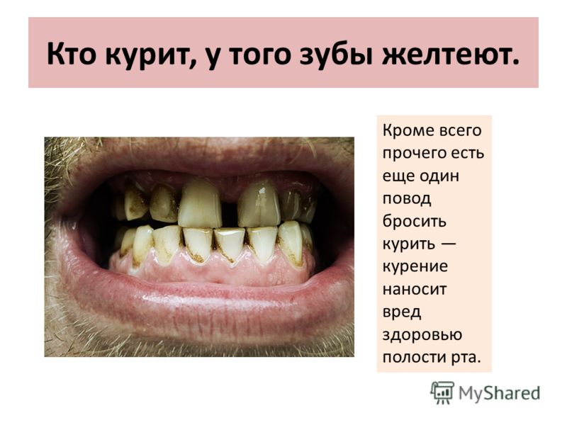 Вредный состав крема для кожи лица Виферон свечи от бородавок