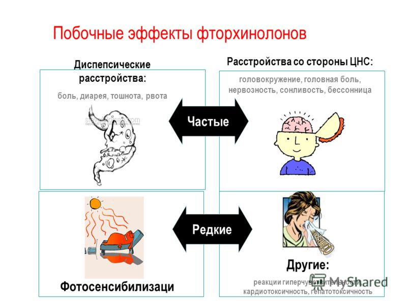 Простатит острый обострение хронического Простатит острый обострение хронического