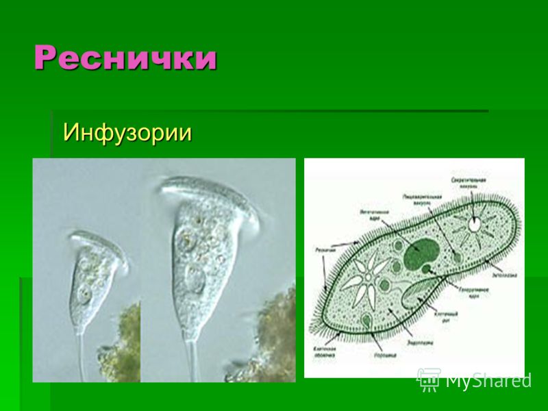 Органы движения инфузории Органы движения инфузории