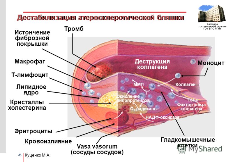 Болезнь витилиго народные методы лечения