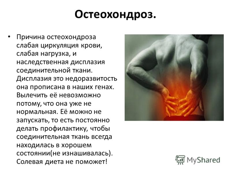 К чему относится заболевание остеохондроз К чему относится заболевание остеохондроз
