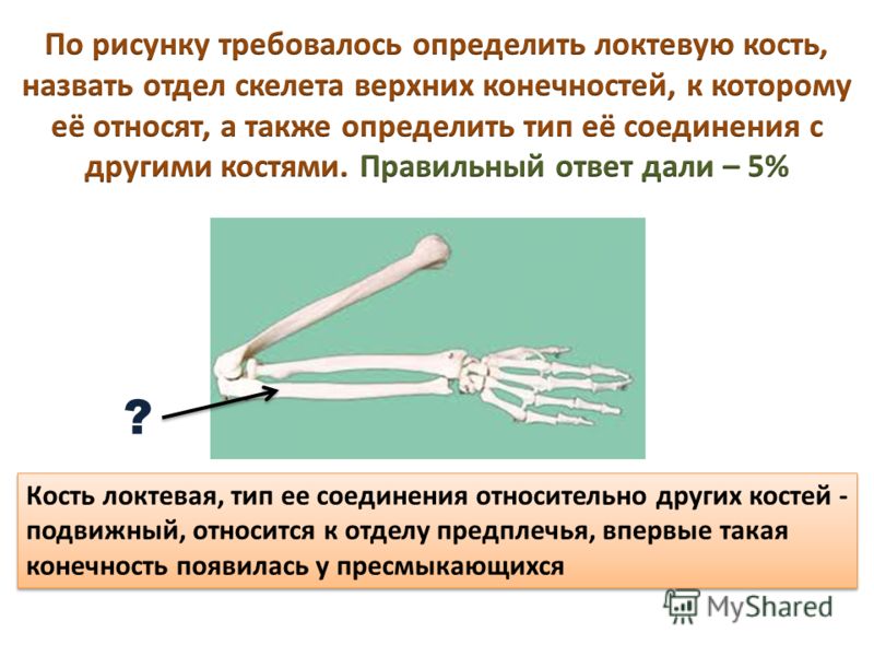 Кость локтевая, тип ее соединения относительно других костей - подвижный, относится к отделу предплечья, впервые такая конечность появилась у пресмыкающихся ?
