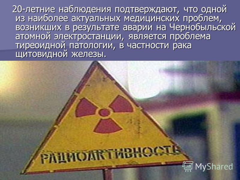 20-летние наблюдения подтверждают, что одной из наиболее актуальных медицинских проблем, возникших в результате аварии на Чернобыльской атомной электростанции, является проблема тиреоидной патологии, в частности рака щитовидной железы. 20-летние набл