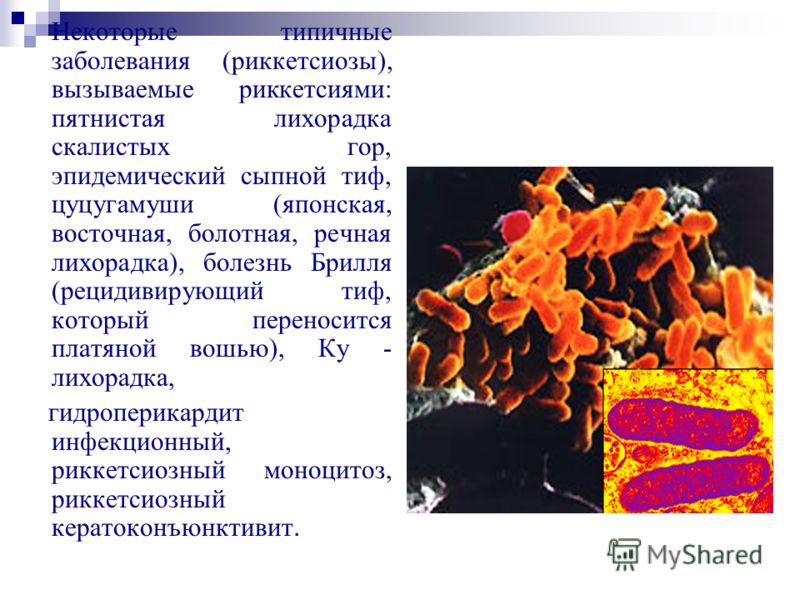 Эндемический Сыпной Тиф Презентация