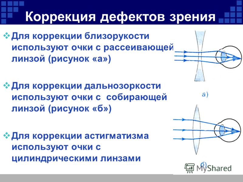 Линзы для коррекции астигматизма что это Линзы для коррекции астигматизма что это