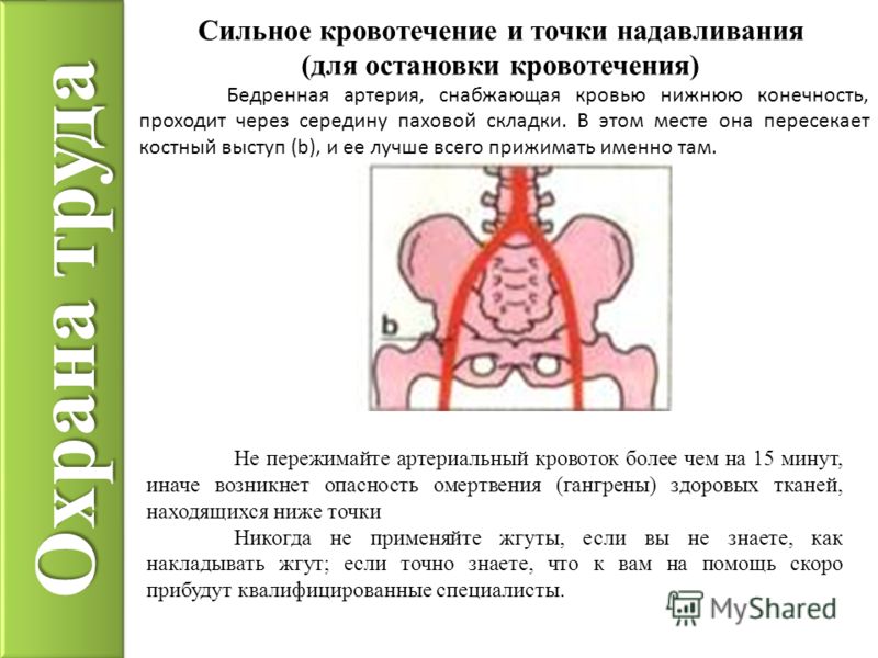 Остановить кровотечение при месячных в домашних условиях