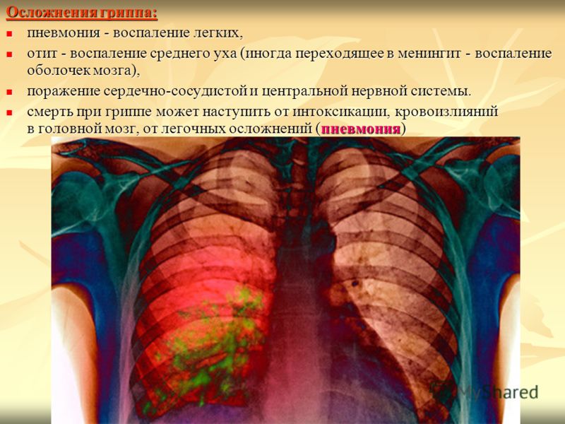 перчатки копии известных брендов