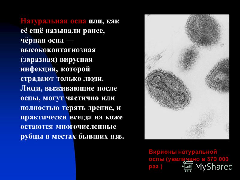 черная оспа фото больных онлайн черная оспа фото больных