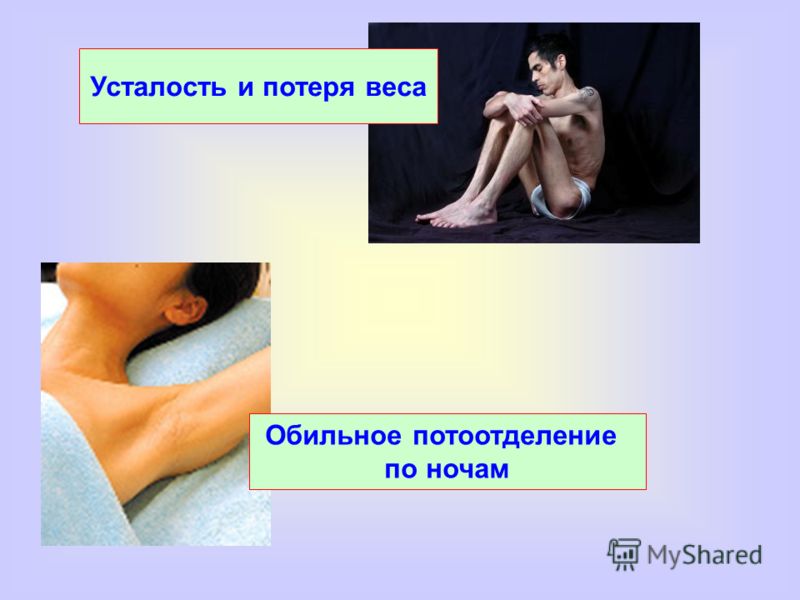 С чем может быть связано сильное потовыделение С чем может быть связано сильное потовыделение